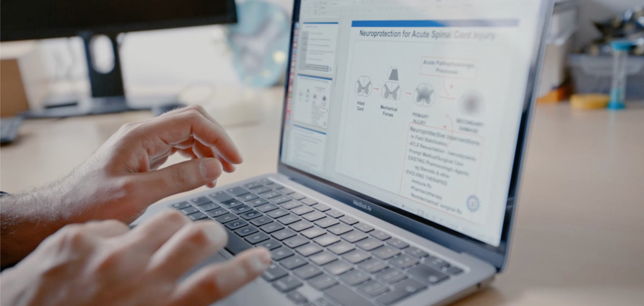 يدان تطبعان على جهاز MacBook Pro‏.